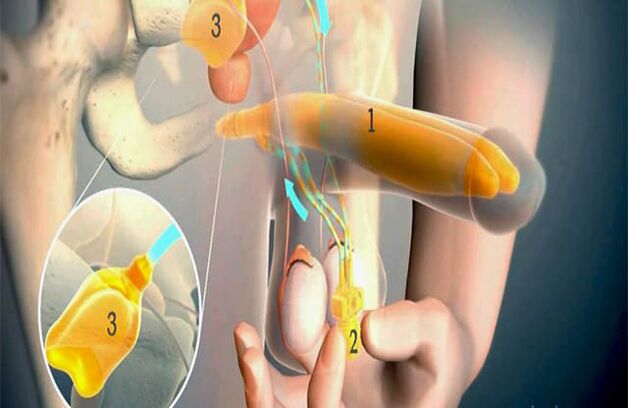Operacija lipofillinga